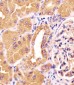 PCCA Antibody (Center)